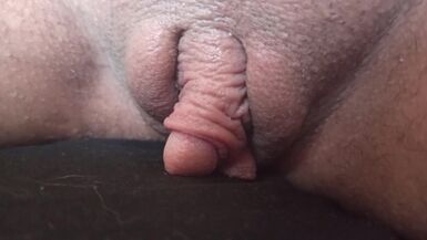 Trans Ftm has a Big Clit