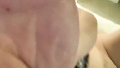 M2F transsexual after orchiectomy - 8 image