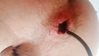 Trans anal dildo and balloon - 15 image