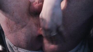 Gaping Anal Slut wishing this were you - 15 image