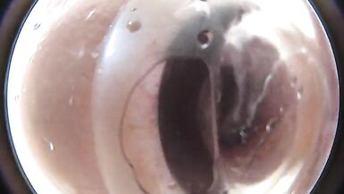 Lizzy Yum glory hole - colon and anus kiss camera post op anal close up glory hole #2 - 8 image