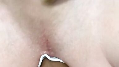 Doc gives Michelle a prostrate exam the old fashioned way - 4 image