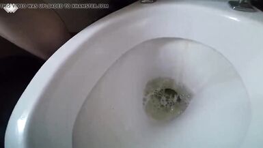 Private t-girls pont of time with void urine - 8 image