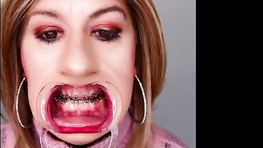 Braces fetish! See Alexandra Braces with an open mouth expander - 13 image