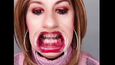 Braces fetish! See Alexandra Braces with an open mouth expander - 14 image
