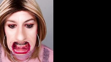 Braces fetish! See Alexandra Braces with an open mouth expander - 3 image