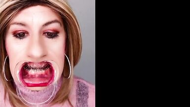 Braces fetish! See Alexandra Braces with an open mouth expander - 9 image