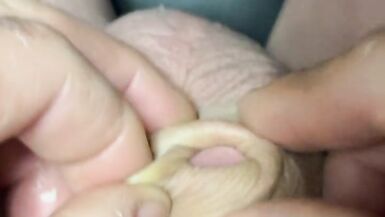 Inverted cock multiple orgasm