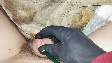 Entire large pencil in the urethra - 9 image