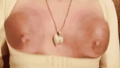 Sore Tits for the use thereof. - 4 image